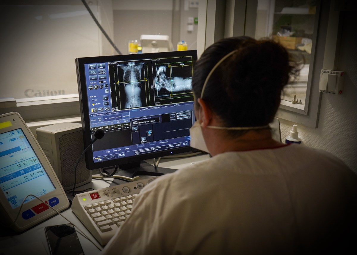 Doctor observing the images of a scanner in the emergency room of a university hospital.